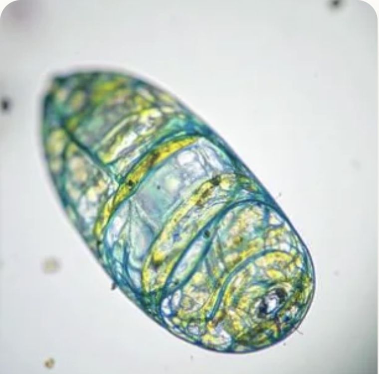 Microscopy image of a living cell showing internal structures